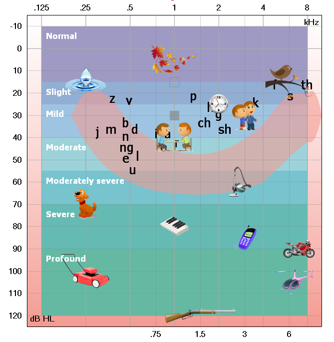 audiograms